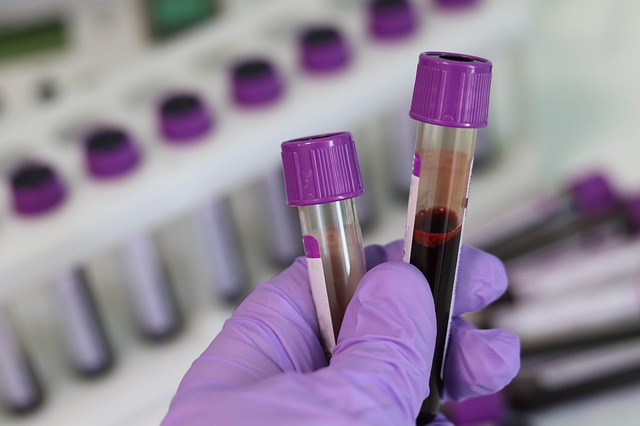 Ovulation Lab Tests